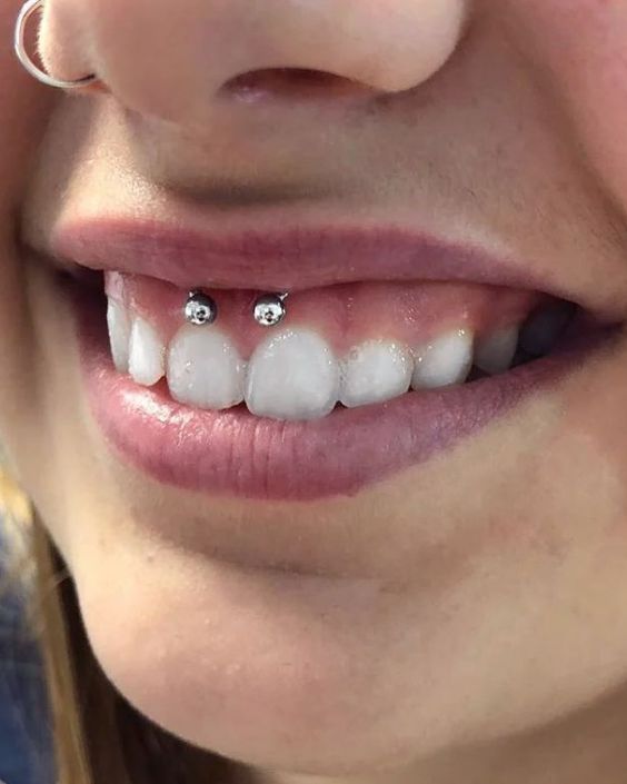 Smiley Piercing