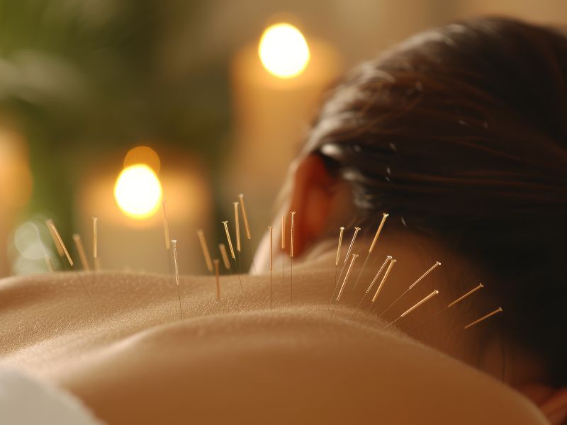 Acupuncture