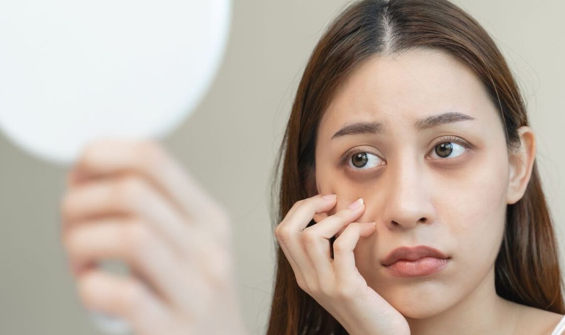 Get Rid of Under Eye Dark Circles