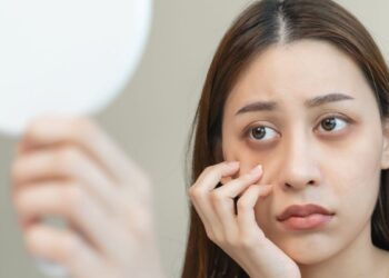 Get Rid of Under Eye Dark Circles