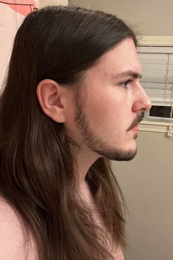 Patchy Chinstrap