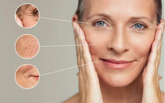Mature woman with skin concerns